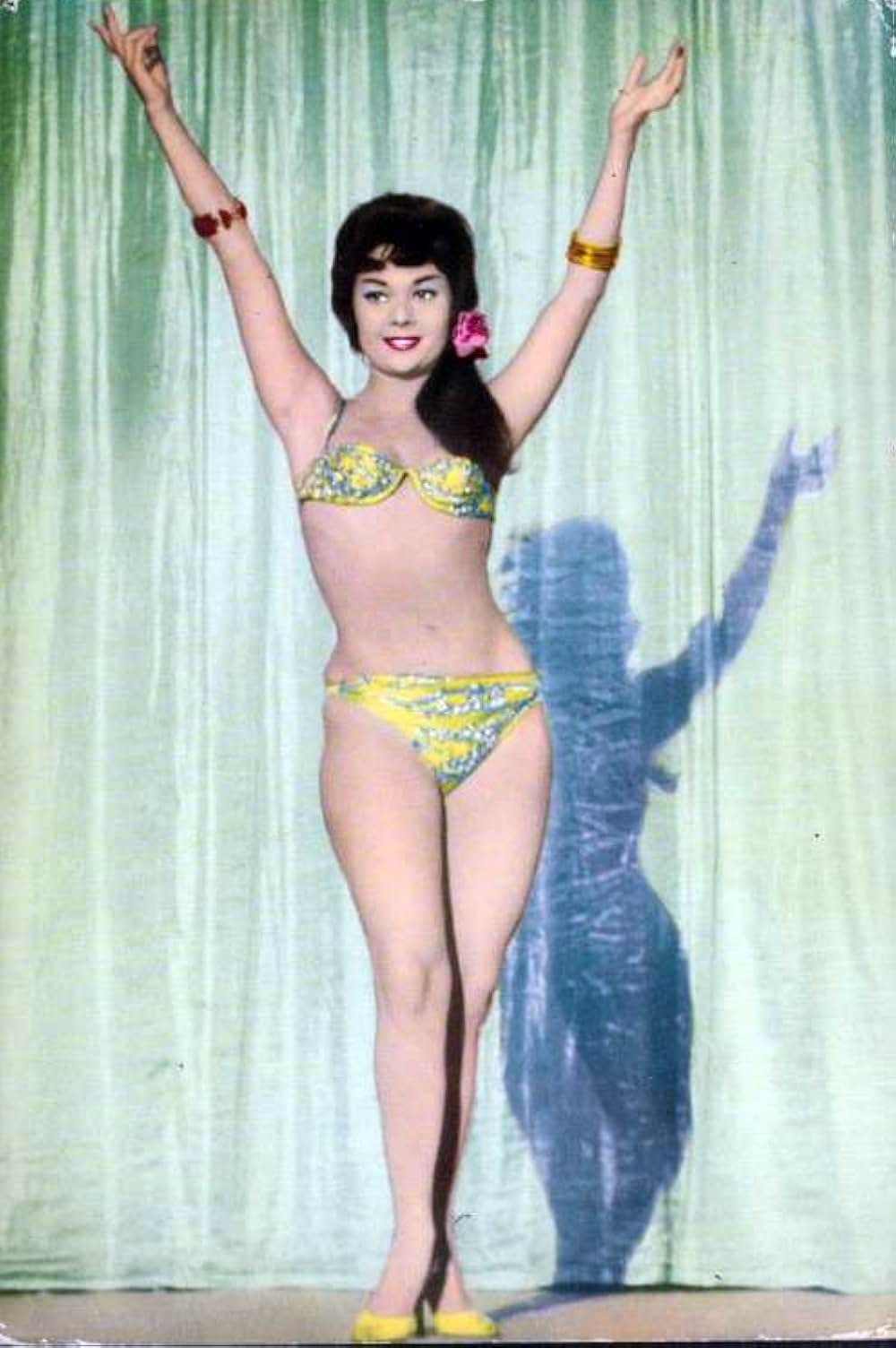 The Hands of Orlac（原題）の画像