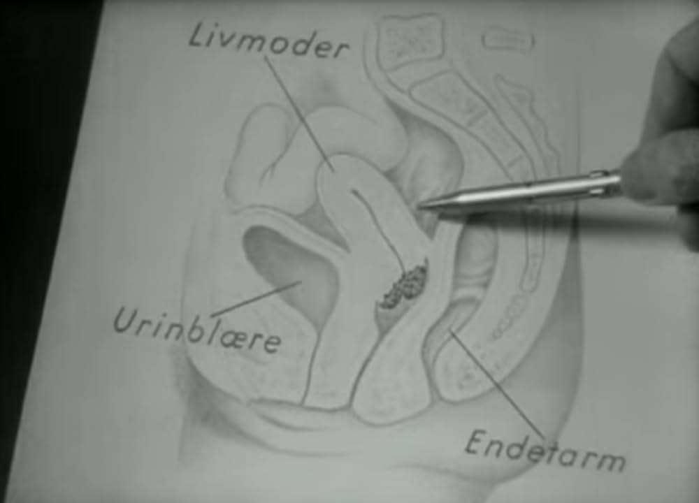 癌との戦いの画像
