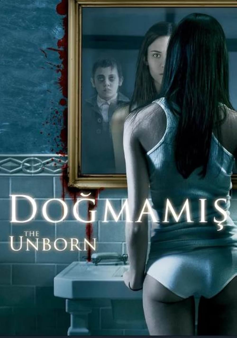 アンボーンの画像