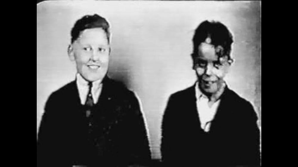 トミー・タッカーの歯の写真
