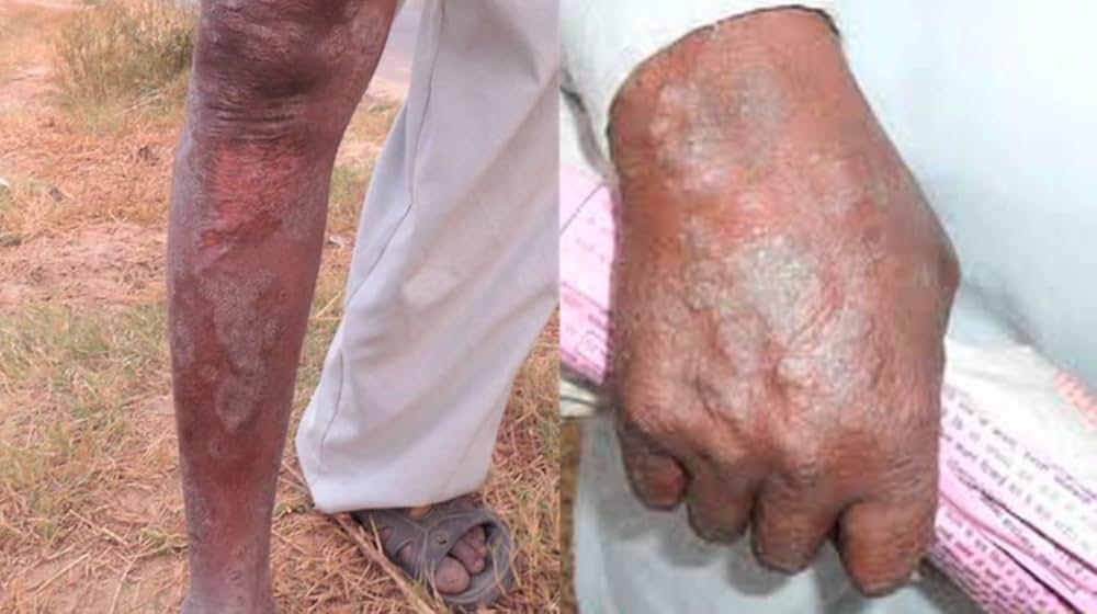 遺伝子組み換えルーレット ―私たちの生命のギャンブルの画像