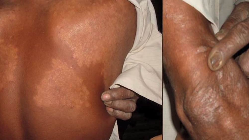 遺伝子組み換えルーレット ―私たちの生命のギャンブルの画像