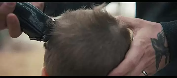 SKIN スキンの画像