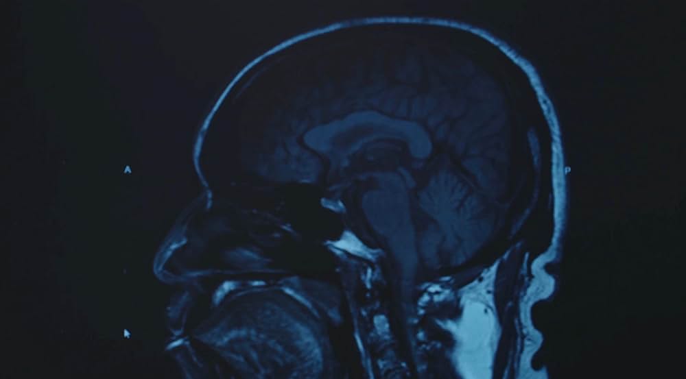 Swamp Dogg Gets His Pool Painted（原題）の画像