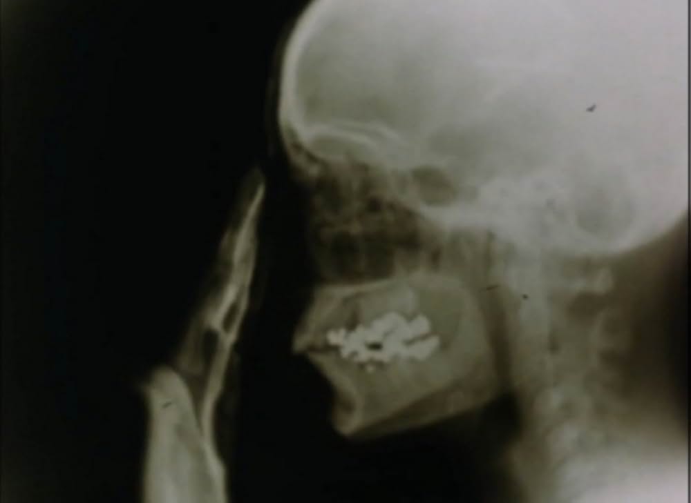 サンクタスの画像