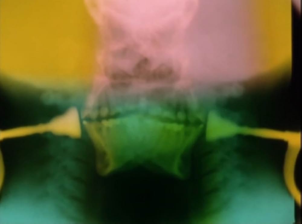 サンクタスの画像