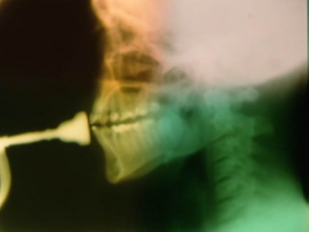 サンクタスの画像