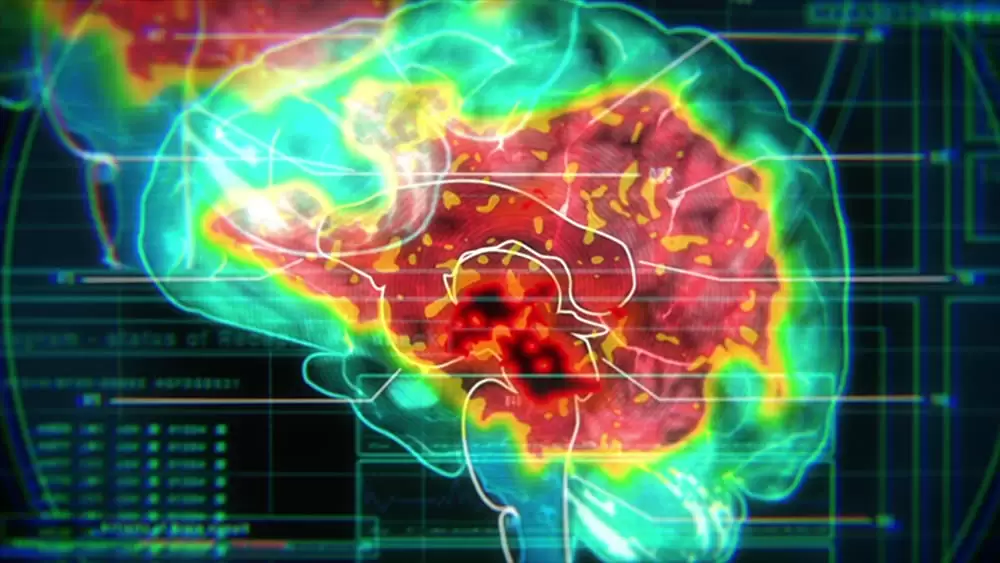 虐殺器官の画像