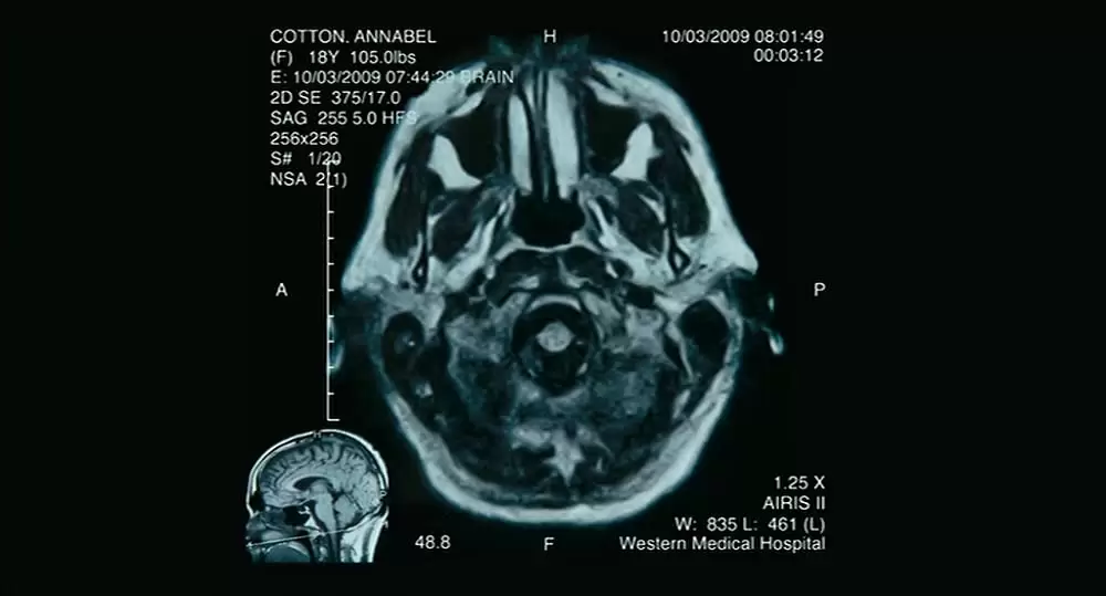 永遠の僕たちの画像