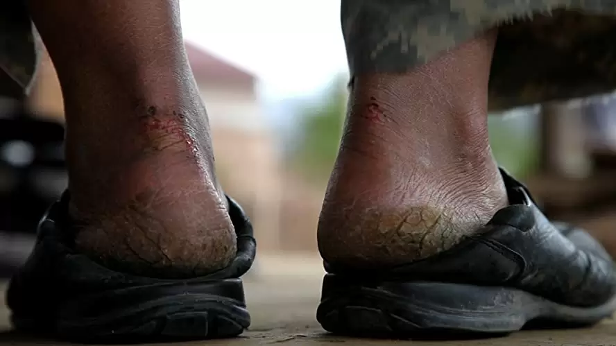 アリランの画像