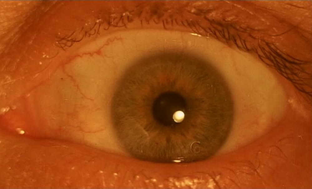 ゴーレムの画像