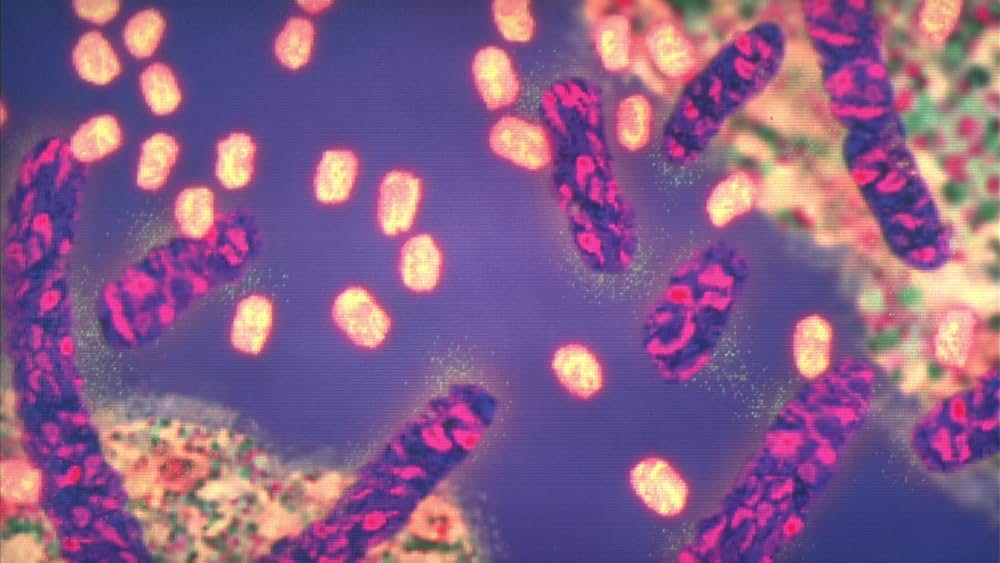 ブラック・ジャックの画像