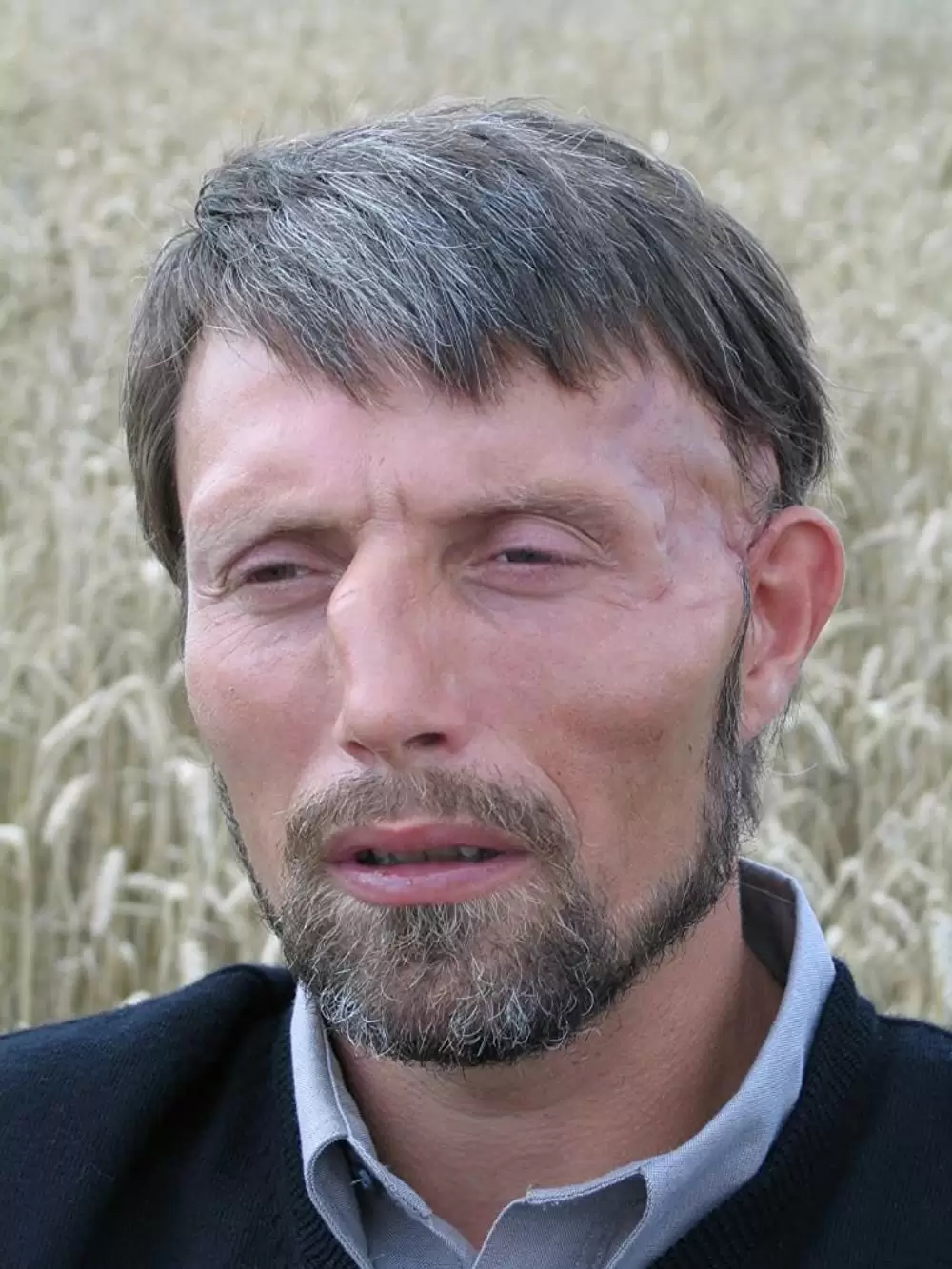 アダムズ・アップルの画像