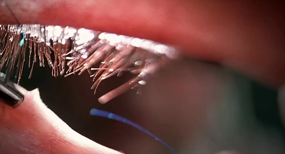 潜水服は蝶の夢を見るの画像