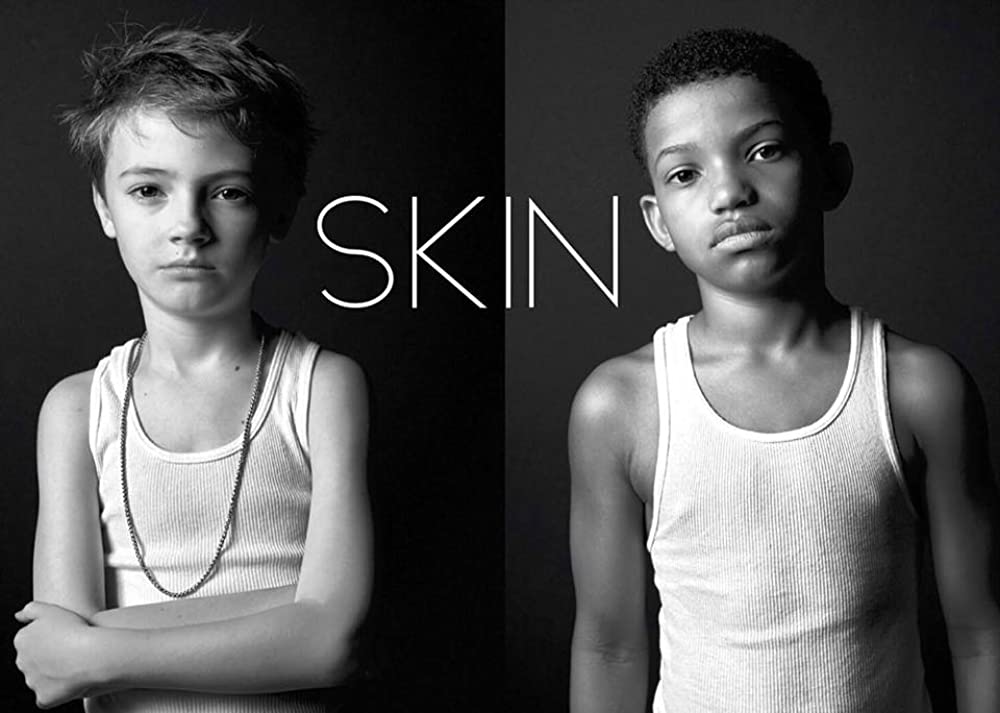 SKIN 短編の画像