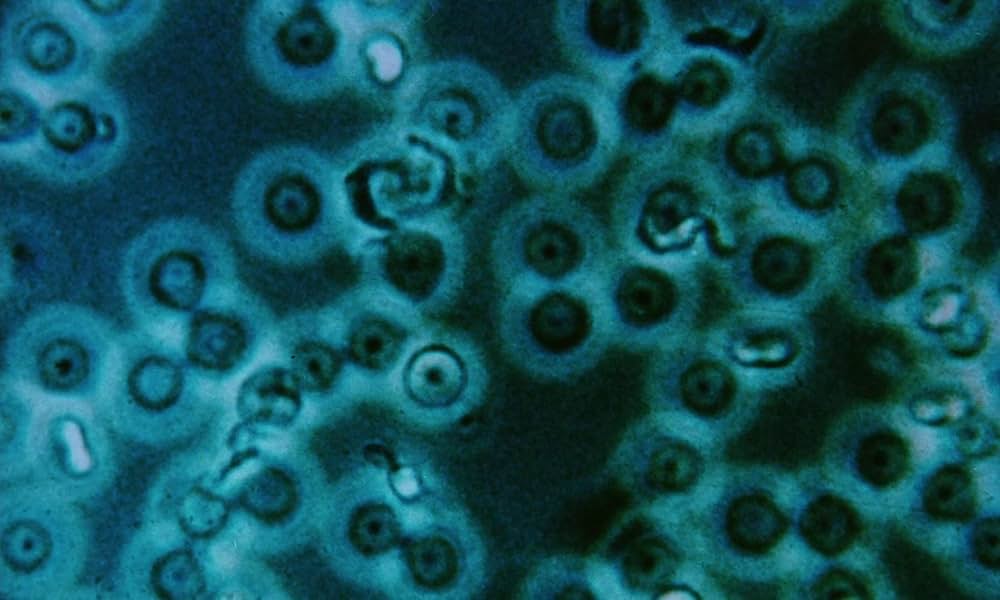 ラビッドの画像