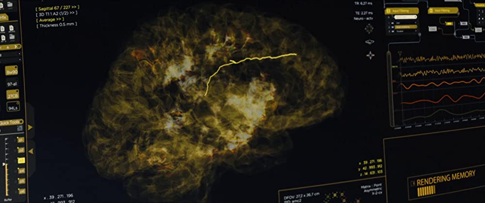 レミニセンスの画像