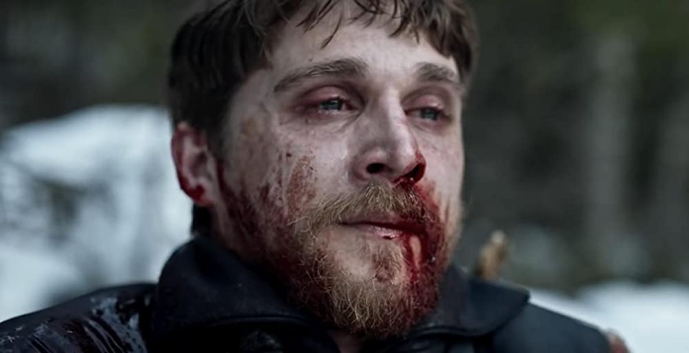 赤い光点の画像