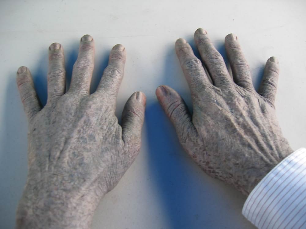 ゾンビーノの画像