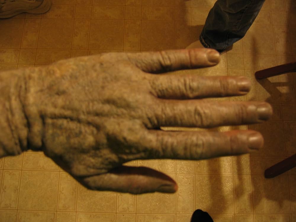 ゾンビーノの画像