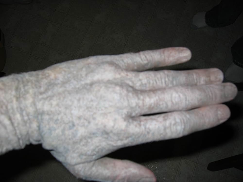 ゾンビーノの画像