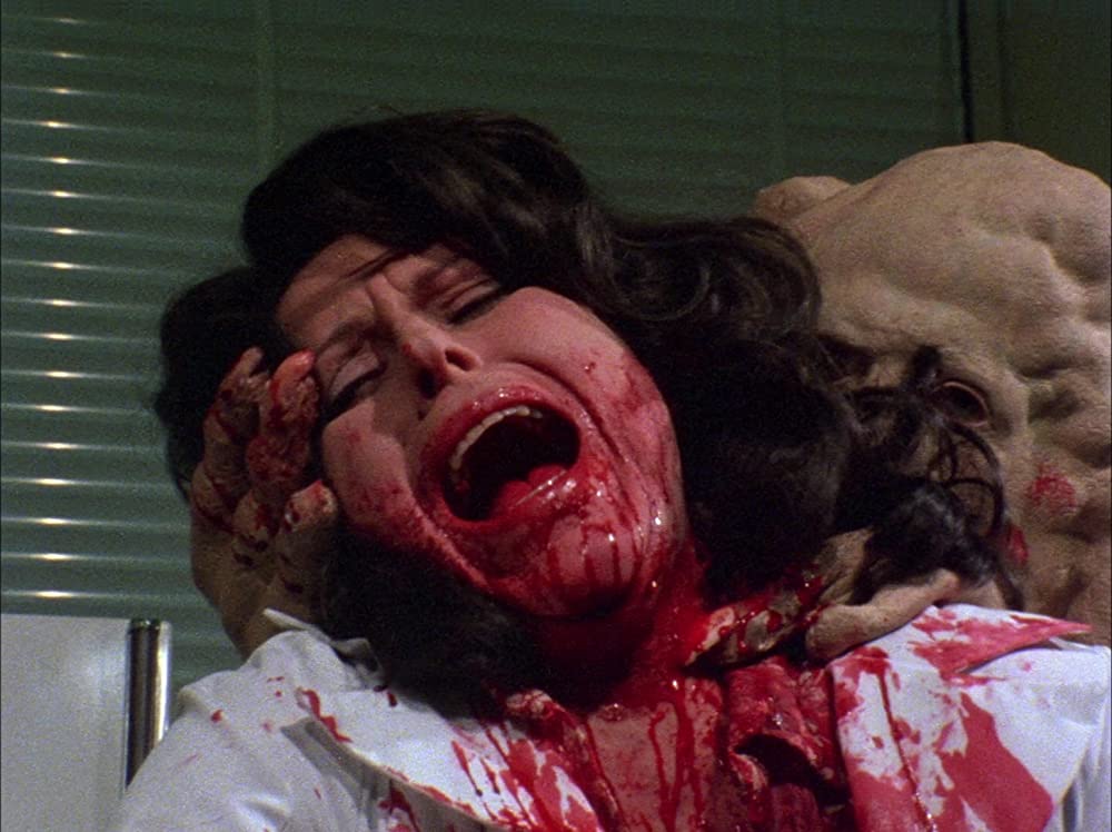 バスケット・ケースの画像