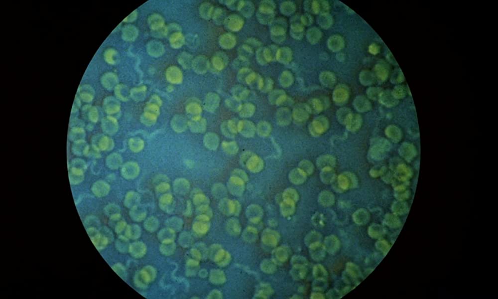 ワンダーウォールの画像