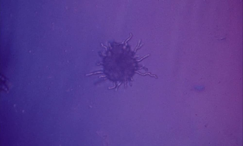 ワンダーウォールの画像