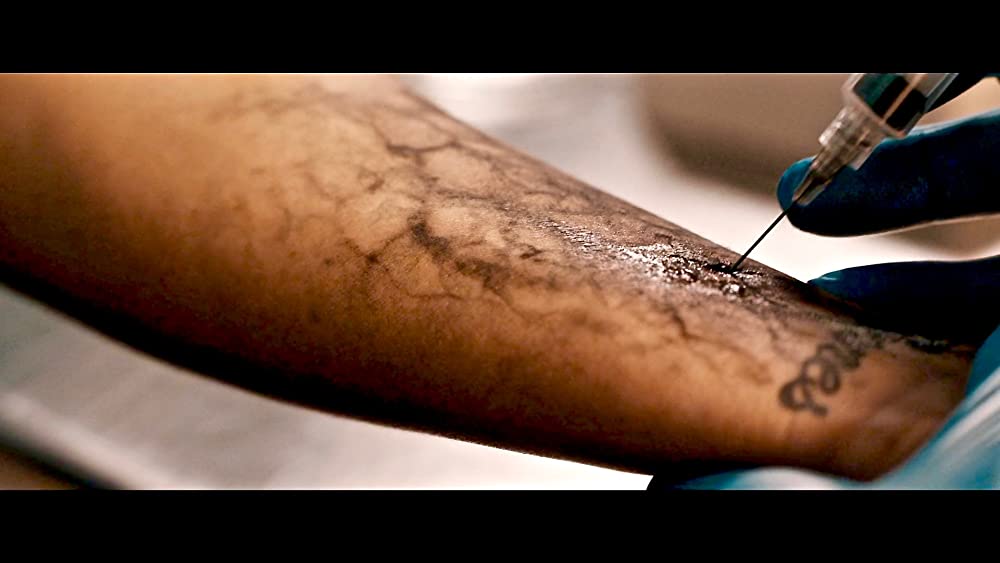 フラッシュバーンの画像