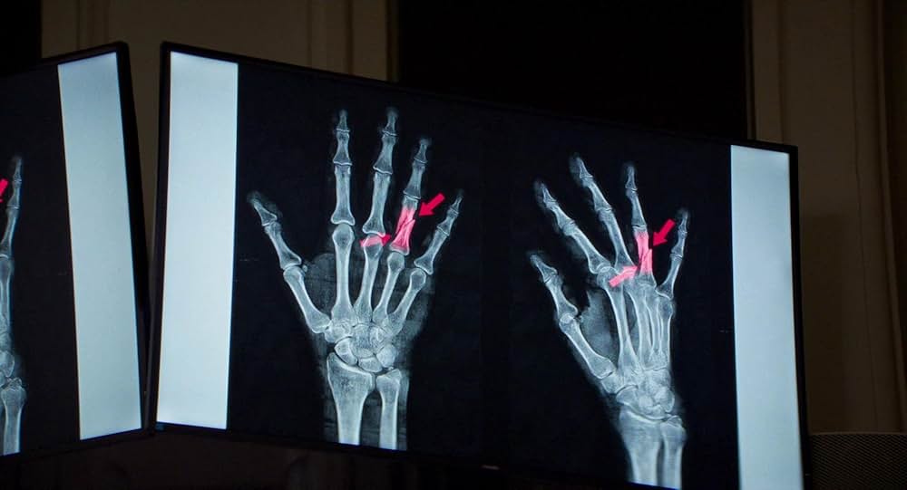 落下の解剖学の画像