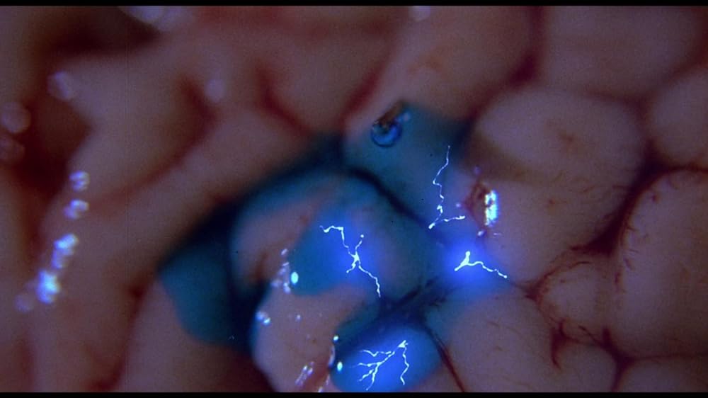 ブレインダメージの画像