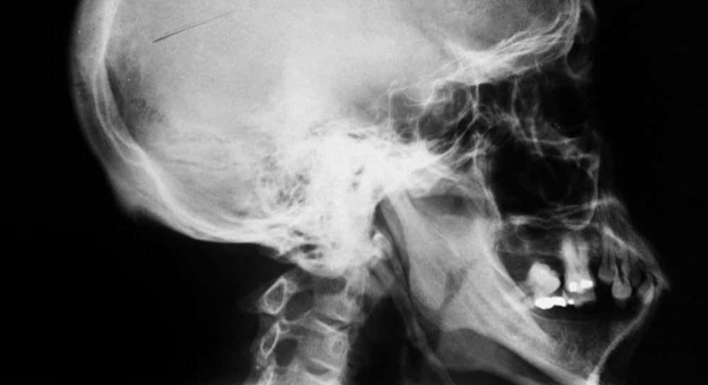 スターダスト・メモリーの画像