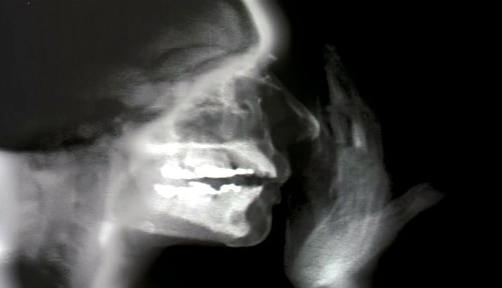 ナコイカッツィの画像