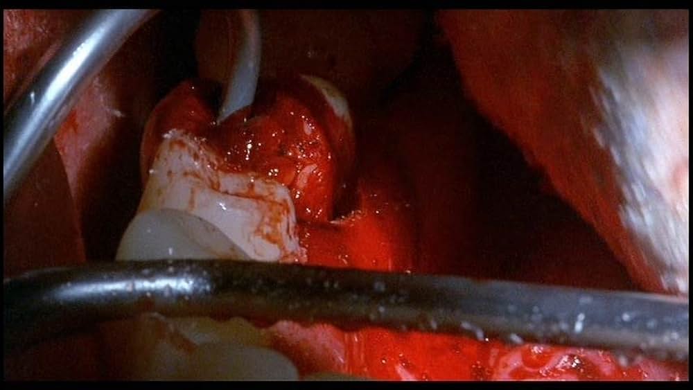 キラー・デンティストの画像