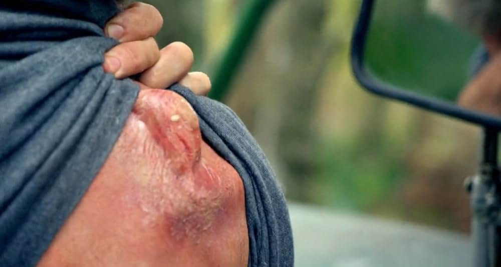 スパイダー・シティの画像