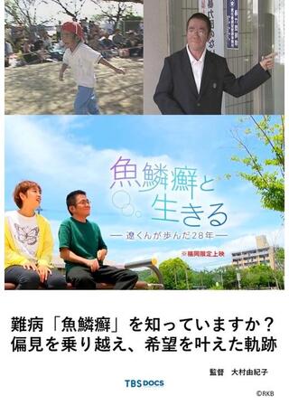 魚鱗癬と生きる ー遼くんが歩んだ２８年ーのポスター