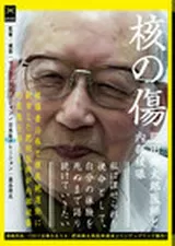 核の傷:肥田舜太郎医師と内部被曝のポスター