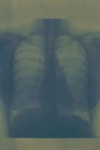 別離のポスター