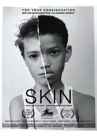 SKIN 短編のポスター