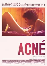 アクネ ACNEのポスター