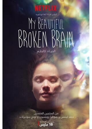 我が美しき壊れた脳のポスター